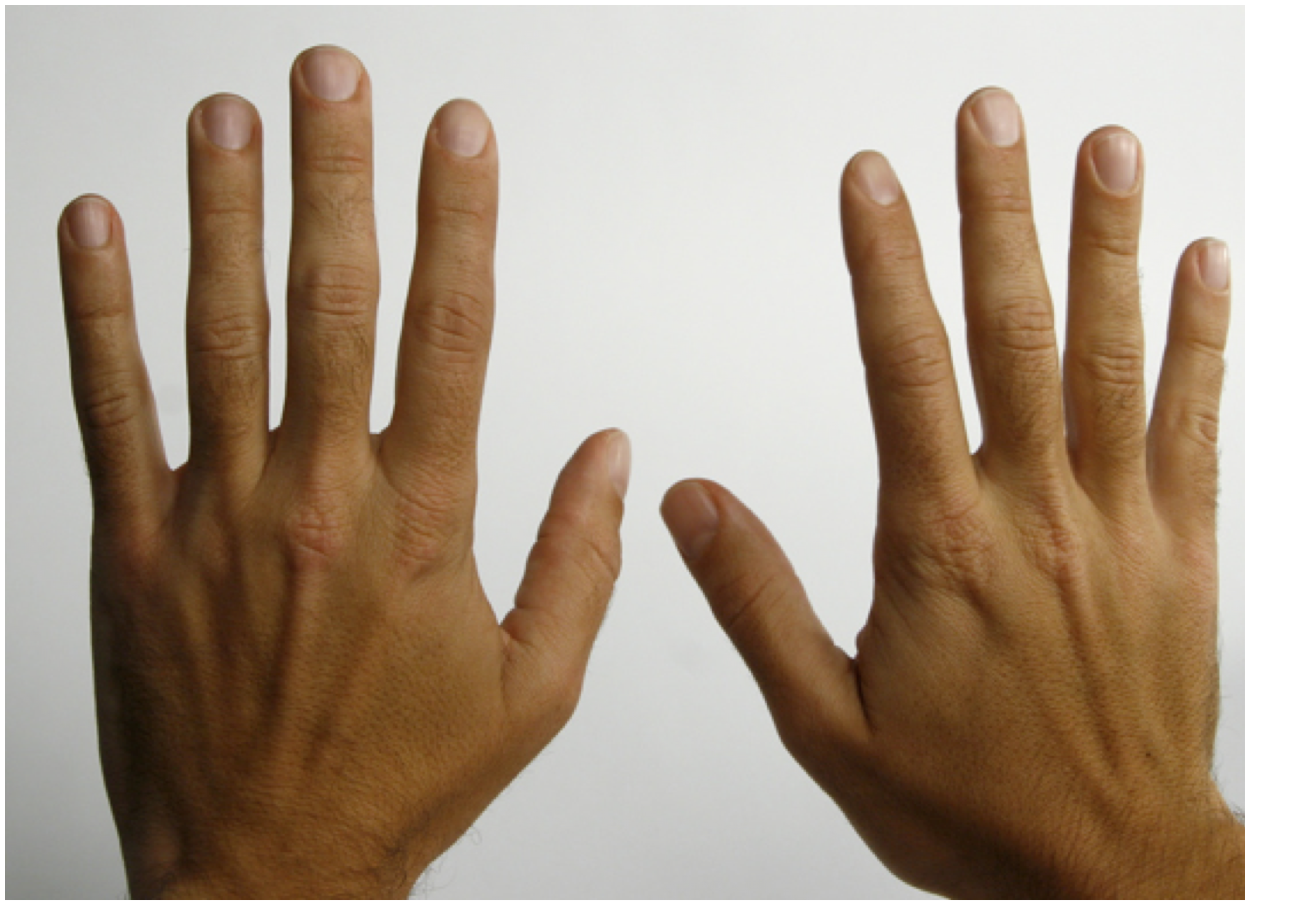 Two hands held up with palms facing out.