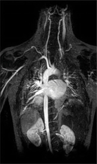 An MRI image of a human torso. 