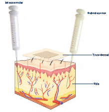 Drug entering bloodstream directly though a subcutaneous injection.