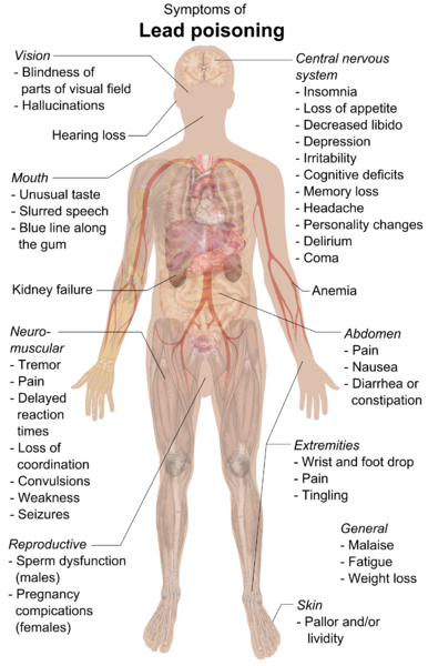 Labeled diagram of a human body and the ways lead poisoning affects different areas of the body.