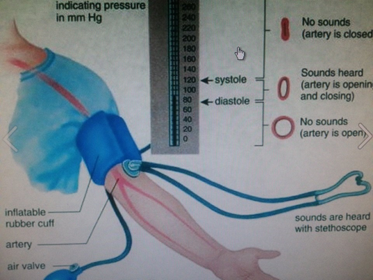 Un profesional de la salud que realiza monitoreo de la presión arterial en un paciente