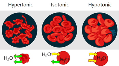 Hemólisis y crenación de glóbulos rojos