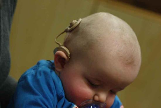 photograph of a baby with an electrical probe attached to their head.