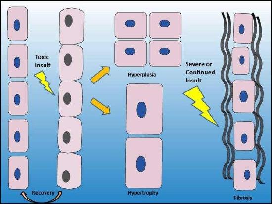 Figure 5.1  Normal cells (at left) that are exposed to a toxic insult may undergo degeneration, characterized by cellular swelling.  Repair responses to cellular injury include increased cell numbers (hyperplasia) and increased cell size (hypertrophy).  When exposed to continued toxic insult or when cellular injury is severe, the repair process may include formation of excessive extracellular connective tissue (fibrosis).