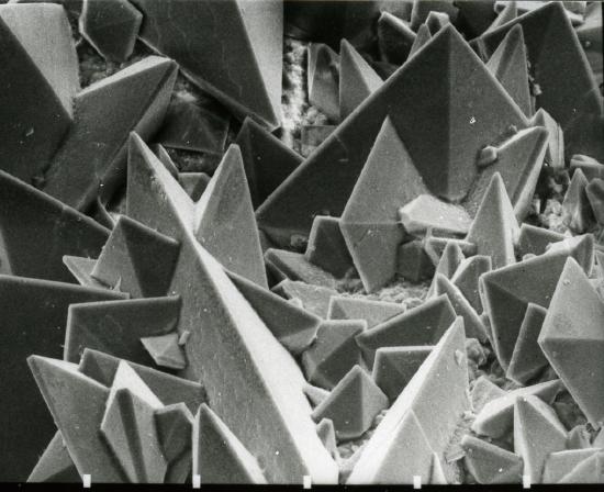 File:Surface of a kidney stone.jpg - Wikimedia Commons