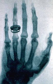 180px-Roentgen-x-ray-1896-01-23.jpg