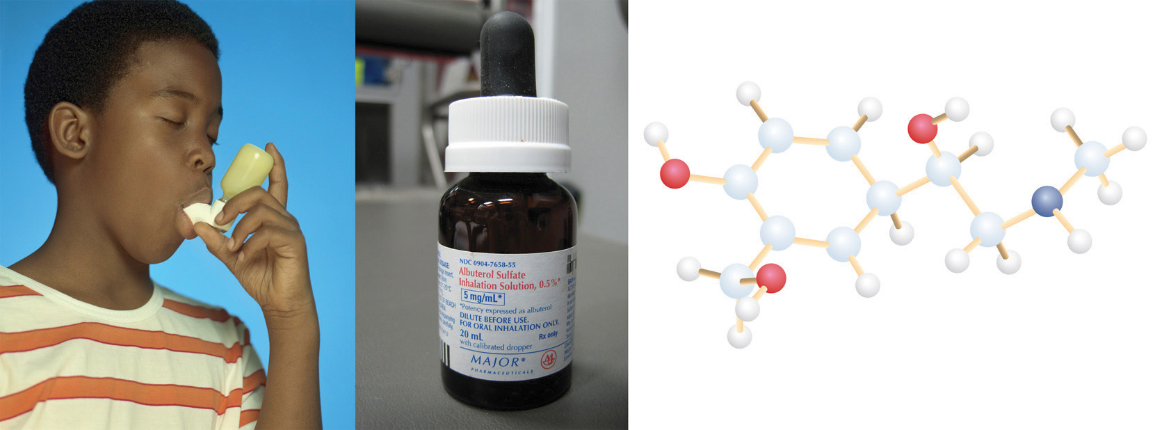 En tres imágenes combinadas se muestra un niño que usa un inhalador de albuterol, el recipiente de medicamento para albuterol y un modelo molecular de la molécula de albuterol.
